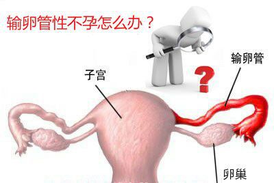 输卵管堵塞需要做哪些不孕检查